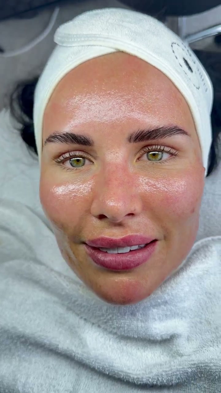 Aquafacial – Behandlung im Glam Beauty Studio Garching