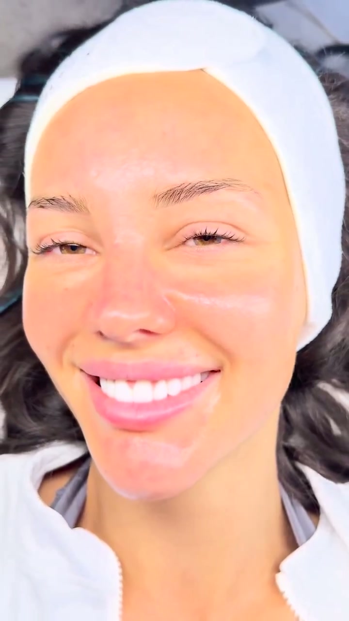 Aquafacial – Sichtbares Hautergebnis im Glam Beauty Studio Garching